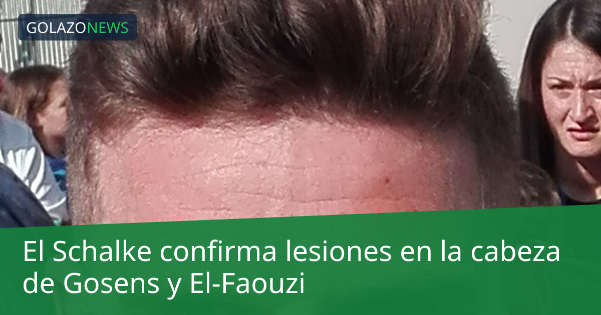 El Schalke confirma lesiones en la cabeza de Gosens y El-Faouzi