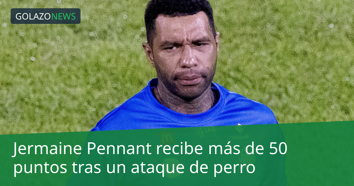 Jermaine Pennant recibe más de 50 puntos tras un ataque de perro