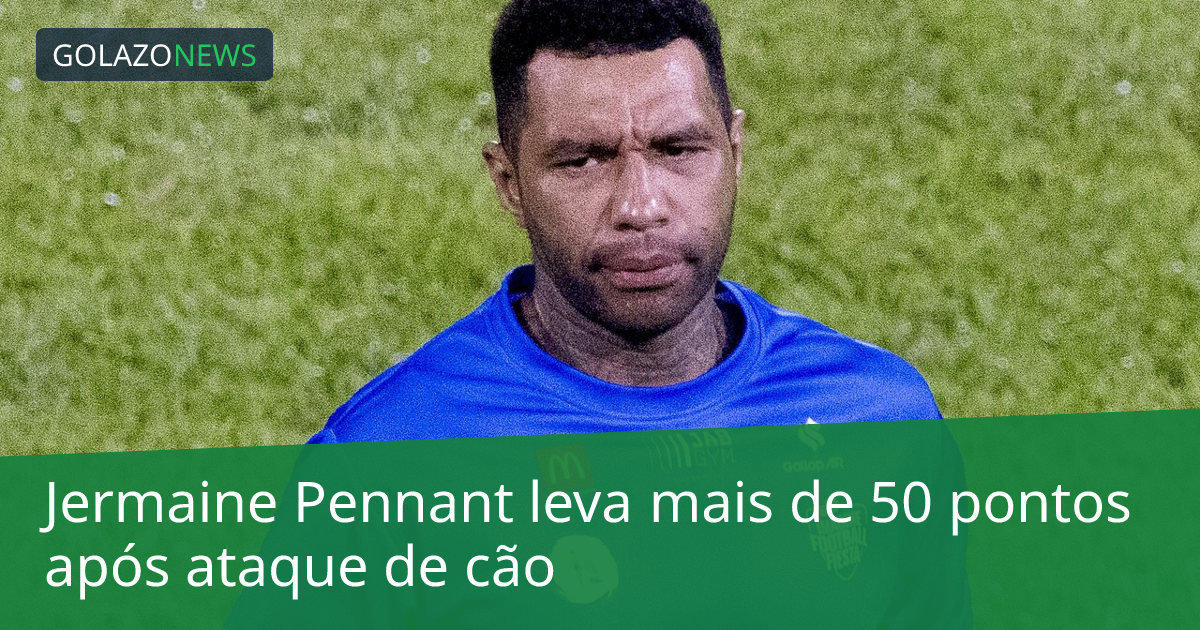 Jermaine Pennant leva mais de 50 pontos após ataque de cão